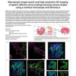 Macroscopic target search and high-resolution 3D imaging of gastric afferent nerve endings showing various shapes using a confocal microscope and Denoise.ai