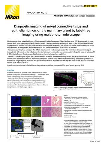 Chẩn đoán khối u mô liên kết và biểu mô hỗn hợp tuyến vú bằng hình ảnh không nhuộm từ kính hiển vi đa photon