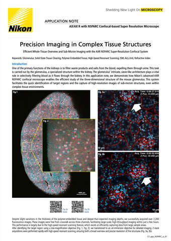 Chụp ảnh chính xác trong cấu trúc mô phức tạp