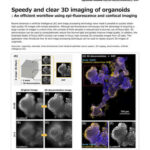 Speedy and clear 3D imaging of organoids