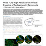 Wide FOV, High-Resolution Confocal Imaging of Podosomes in Osteoclasts ~ Macro and micro observation ~