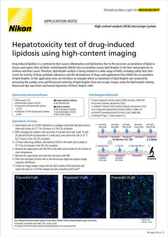 Kiểm tra độc tính gan do tích mỡ gây ra bởi thuốc bằng chụp ảnh nội dung cao