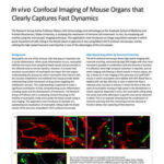 In vivo Confocal Imaging of Mouse Organs that Clearly Captures Fast Dynamics