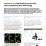 Visualization of microglia-neuron junctions with super-resolution and confocal microscopy